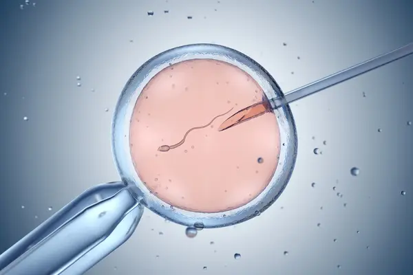 IVF-icsi