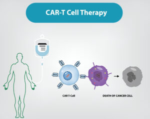 cart-cell-therapy